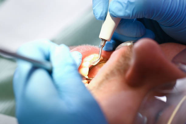 Best Emergency Gum Treatment in Mccoll, SC